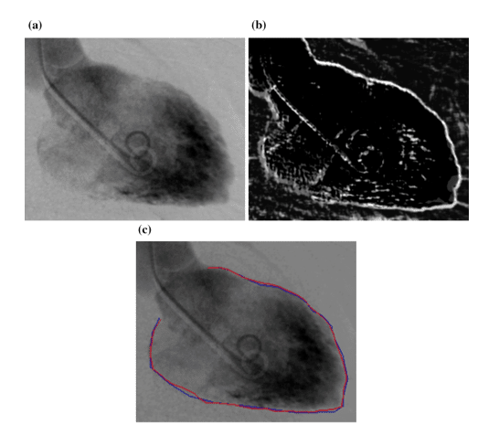 L’attribut alt de cette image est vide, son nom de fichier est figure-8-the-image-of-a-left-ventricle-of-the-heart-b-edge-enhancement-by-nee-comparison-between-hand-segmentation-and-nee-results.png.