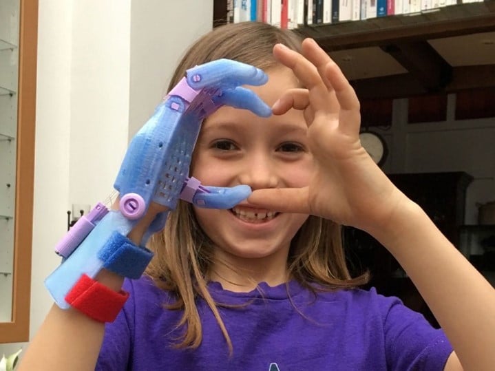 Photographie d’une prothèse de main développée grâce au projet Enabling the future